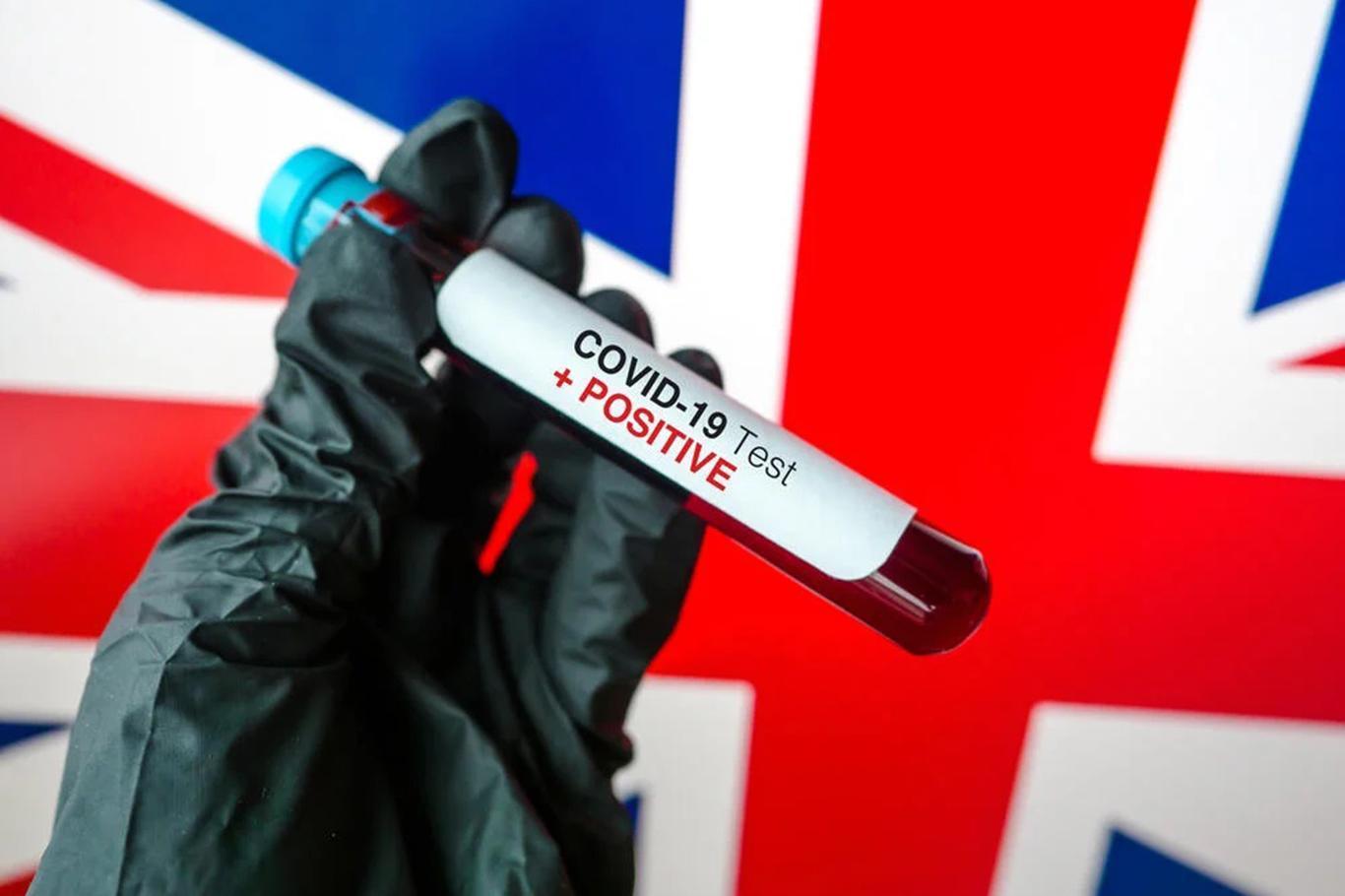 United Kingdom reports 134 new deaths from coronavirus